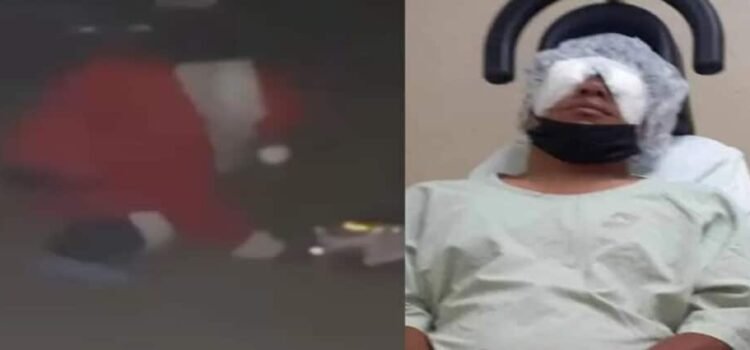 El hombre llamado Miguel que se viste de Santa Claus, pierde el ojo tras la explosión de un cohete