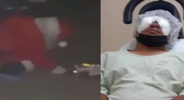 El hombre llamado Miguel que se viste de Santa Claus, pierde el ojo tras la explosión de un cohete El hombre llamado Miguel que se viste de Santa Claus, pierde el ojo tras la explosión de un cohete